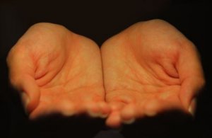 Koe kipu opettajana, ei vihollisena