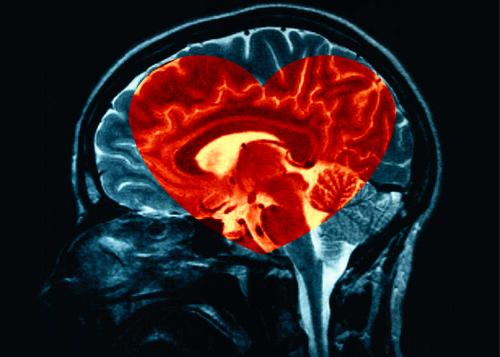 Sydämenmuotoiset aivot