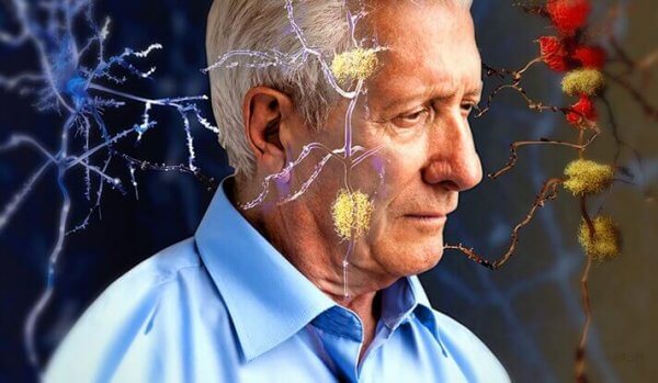 vanhuksella on Alzheimerin tauti