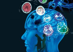 Multippeliskleroosi: syyt, oireet ja hoito