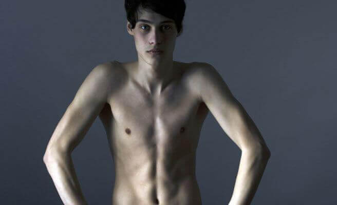 Some figure