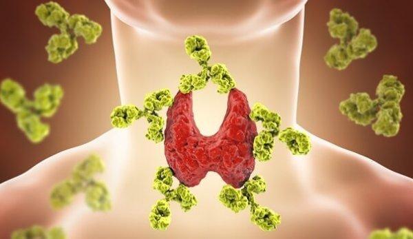 subkliininen hypotyreoosi