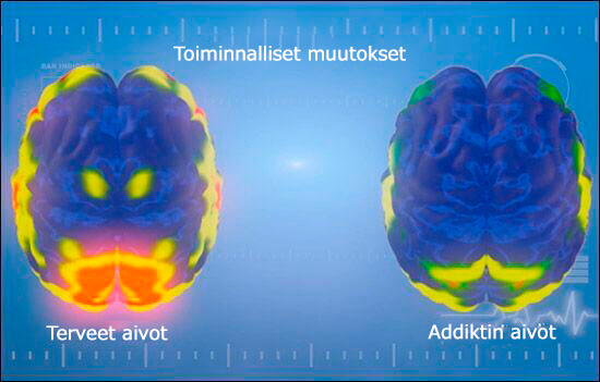addiktin aivot
