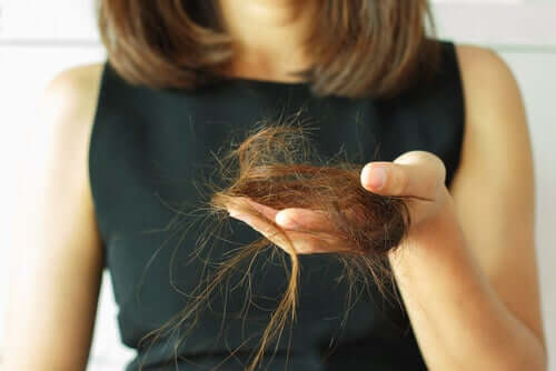 Alopecia tarkoittaa väliaikaista tai pysyvää hiusten menetystä, joka voi olla joko kohtalaista tai vaikeaa