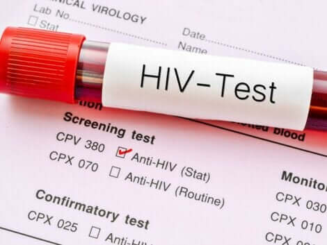 Säännölliset HIV-verikokeet auttavat sekä diagnoosin varhaisessa havaitsemisessa että ehkäisevät tartunnan leviämistä ihmisestä toiseen 