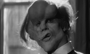 Elefanttimies: pohdintaa ihmisyyden arvokkuudesta