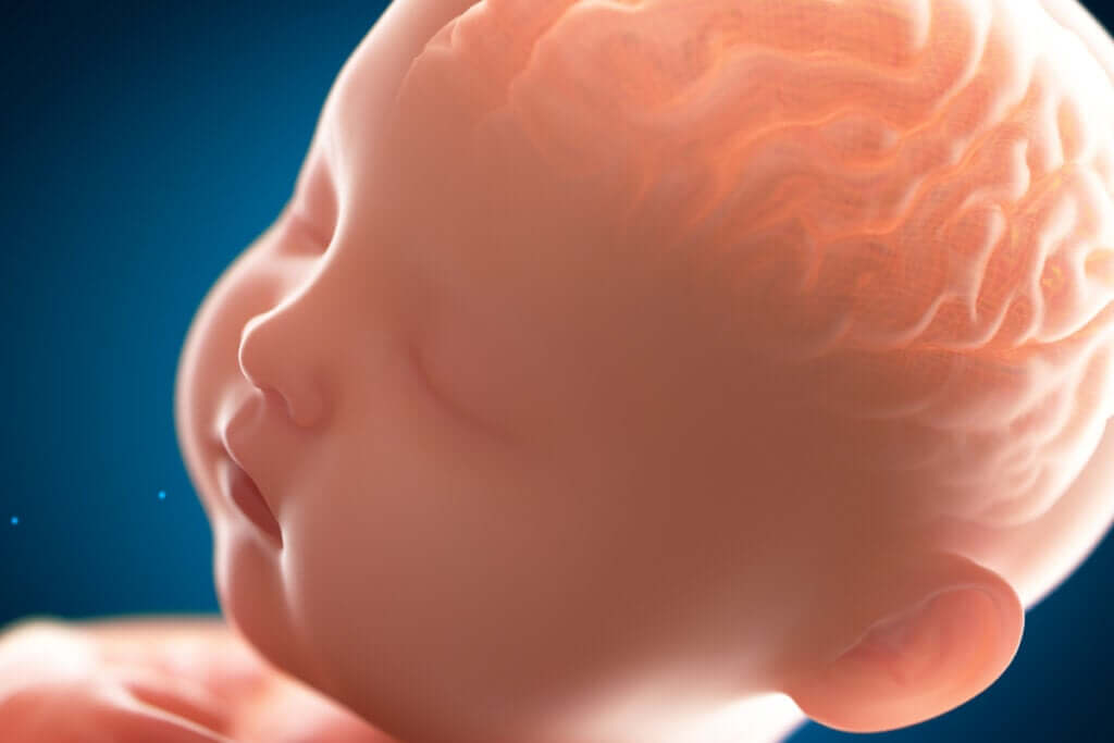 Pakygyria: sairaus, jossa aivot ovat "sileät"